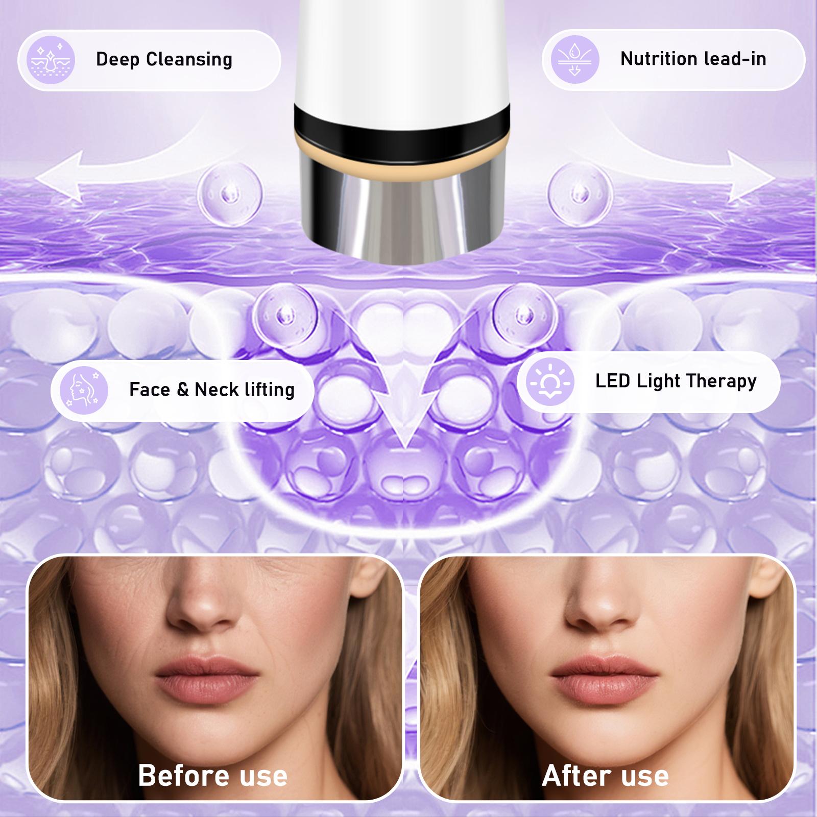 Face Lift Device - Spa-Grade Korean Skin Care Facial Massager, LED Light Therapy for Wrinkles, Skin Tightening & Firming Beauty Device (White)