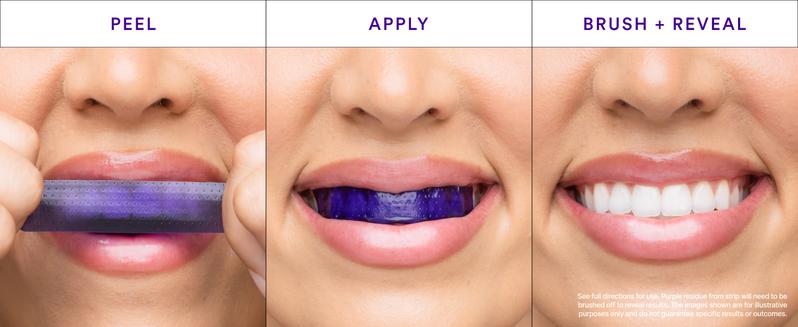 Hismile V34 Whitening Strips, Teeth Whitening Strips, Purple Tooth Whitening, Tooth Stain Treatment, Combining Whitening and Colour Correction Hismile V34 Whitening Strips, Teeth Whitening Strips, Purple Tooth Whitening, Tooth Stain Treatment, Combining Whitening and Colour Correction