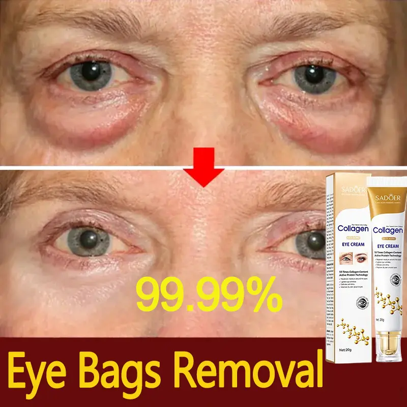 Sadoer Collagen Anti-wrinkle Eye Cream Eye Contour Eye Bags Dark Circles Removal Eye Beauty Cream Serum Korean Cosmetics 20g