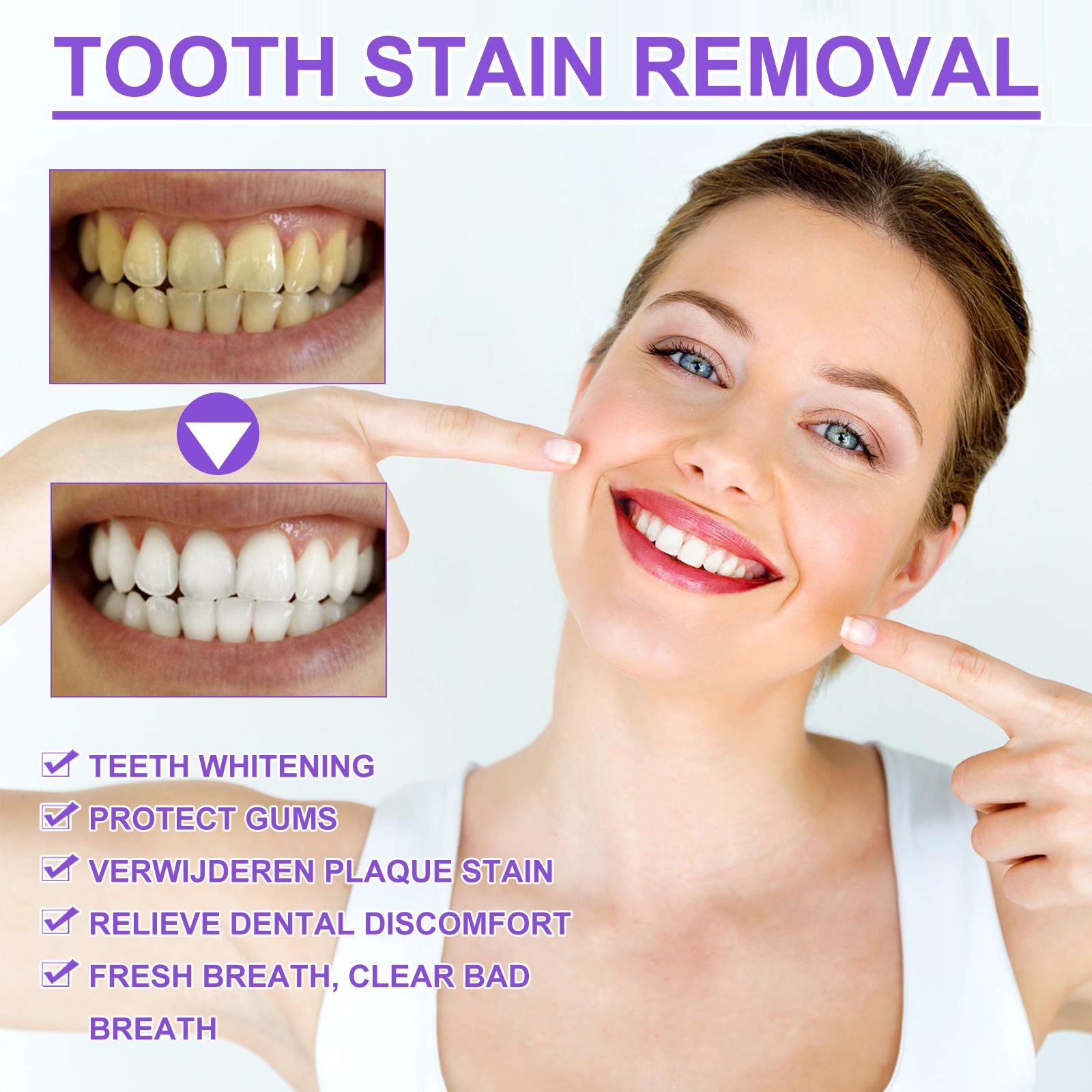 Teeth Brightening Essence, Removes Plaque, Freshens Breath, Soothes Gums, Deep Cleans for White Shiny Teeth