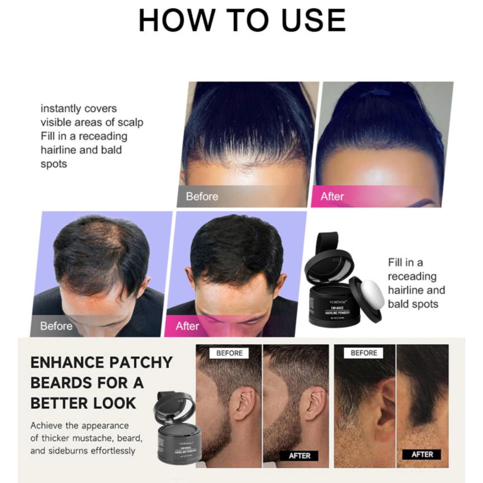 Buy 1 Get 1 Free Hairline Powder，Instantly Conceals Hair Loss, Root Touch up Powder with Squalane for Natural Finish & Grey Touch Ups Windproof & Sweatproof