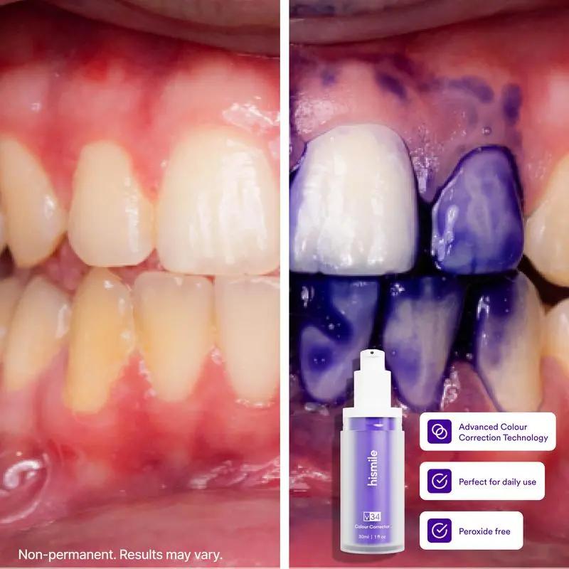 Hismile v34 Colour Corrector - Tooth Stain Concealer, Teeth Brightening Booster, Purple Toothpaste, Colour Correcting,Daily Dental Care