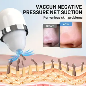 3-in-1 Visual Blackhead Remover with 1080P HD Camera & 25X Magnification, 3 Silicone Suction Heads, USB Rechargeable 1200mAh Battery, Gentle Exfoliation & Suction for All Light Beige Types Including Sensitive Light Beige, White