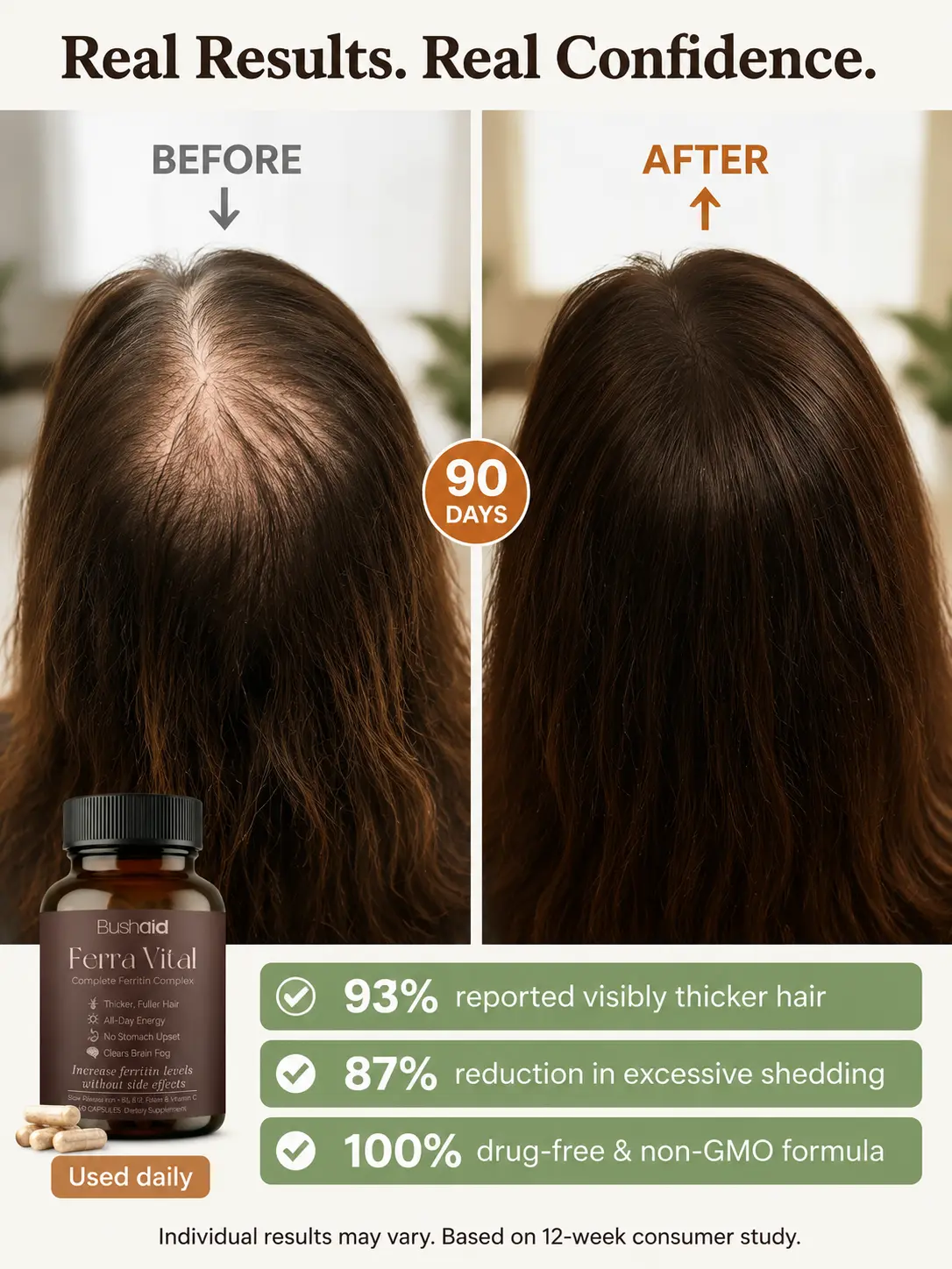 Hair Health Support Capsules – Alleviate Hair Loss