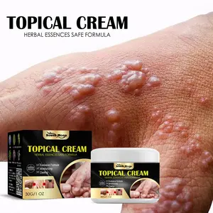South Moon Hand and Foot Itch Relief Cream with White Crane Lingzhi & Snake Gallbladder for Dry Skin & Mosquito Bites Moisturizing Foot Lotion