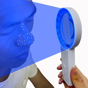 Cordless Wood's Lamp Ringworm Detection Light-Skin Testing-Esthetician-Veterinaria-5x Magnifying Wood Lamp Black Light-16 LED-Battery Powered(Skin Analyzer Woods Lamp) handheld powerful Dermatological Portable