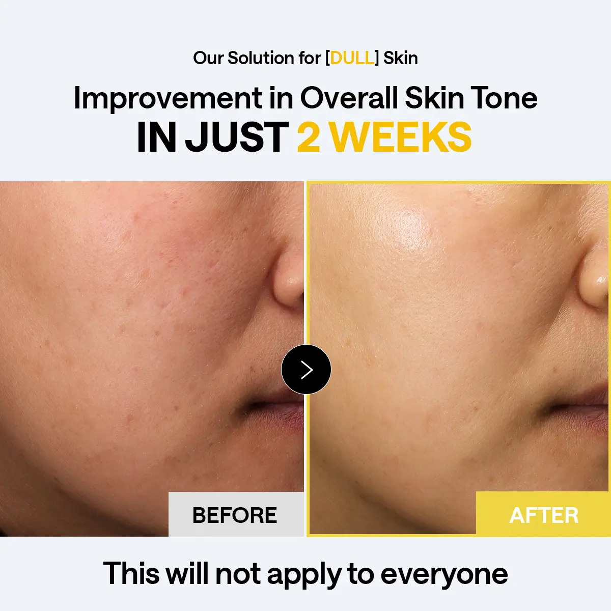MEDIHEAL] Vitamin C Bright Toning Pad (100 pc) | 7 Vitamin Complex +  Glutathione & Niacinamide