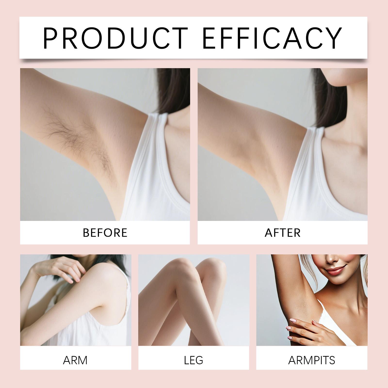 The Body Hair Removal Cream Is Gentle, Clean, Smooth And Fine. It Removes Hair From The Body Skin Without Irritation, Providing A Moist, Comfortable And Refreshing Feeling