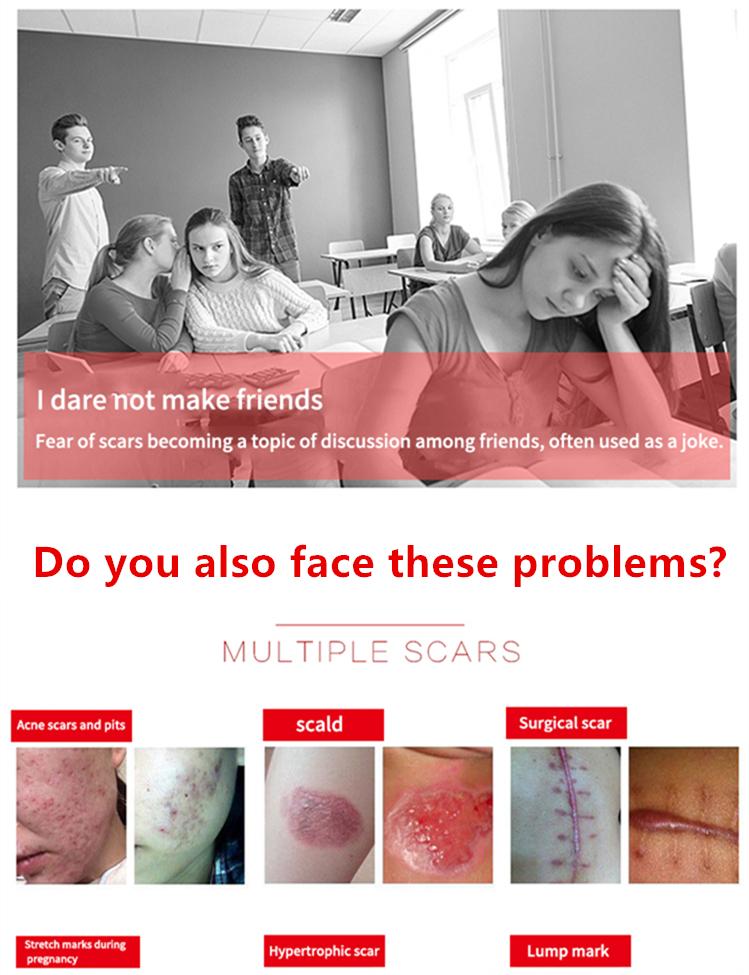 Professional and powerful scar removal gel - suitable for scar removal treatment of post-operative scars, caesarean section scars, keloids, burns, acne, etc.-A Professional and powerful scar removal gel - suitable for scar removal treatment of post-operative scars, caesarean section scars, keloids, burns, acne, etc.-A