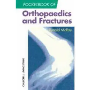 USED-Pocketbook of Orthopaedics and Fractures by Ronald McRae FRCS(Eng  Glas)  FChS(Hon)  AIMBI  Fellow of the British Orthopaedic Association (Paperback)