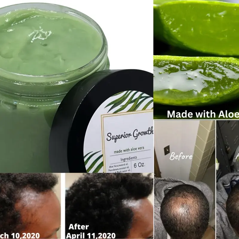pure aloe vera auf haut Aloe Vera Gel Puro, 100 % natürlich, bio, vegan – XXL Lashes main image 1