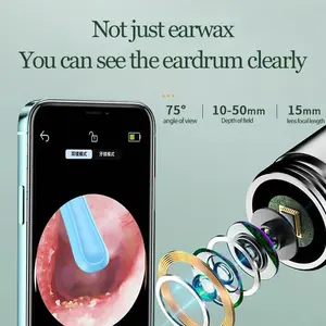 Smart Bluetooth earwax removal tool, visual ear cleaning + gentle suction in one! The mobile APP enables real-time viewing of the ear canal condition. With a precise positioning of 0.3mm, it does not damage the eardrum.