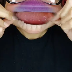 Hismile V34 Whitening Strips, Teeth Whitening Strips, Purple Tooth Whitening, Tooth Stain Treatment, Combining Whitening and Colour Correction