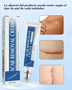 Gentle Cream Scar Therapy Treatment - Healthcare Beauty & Personal Care Body Moisturizer for Fading Burn, Old Acne Scars on Face & Body
