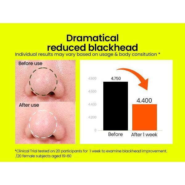 Korea's No.1 Mung Bean Cleansing Oil 200ml | Lightweight Hydrating Powerful Gentle All Skin Types Makeup Remover Moisturizing Moisture Cosmetic Moisturize Korean Moisturizer