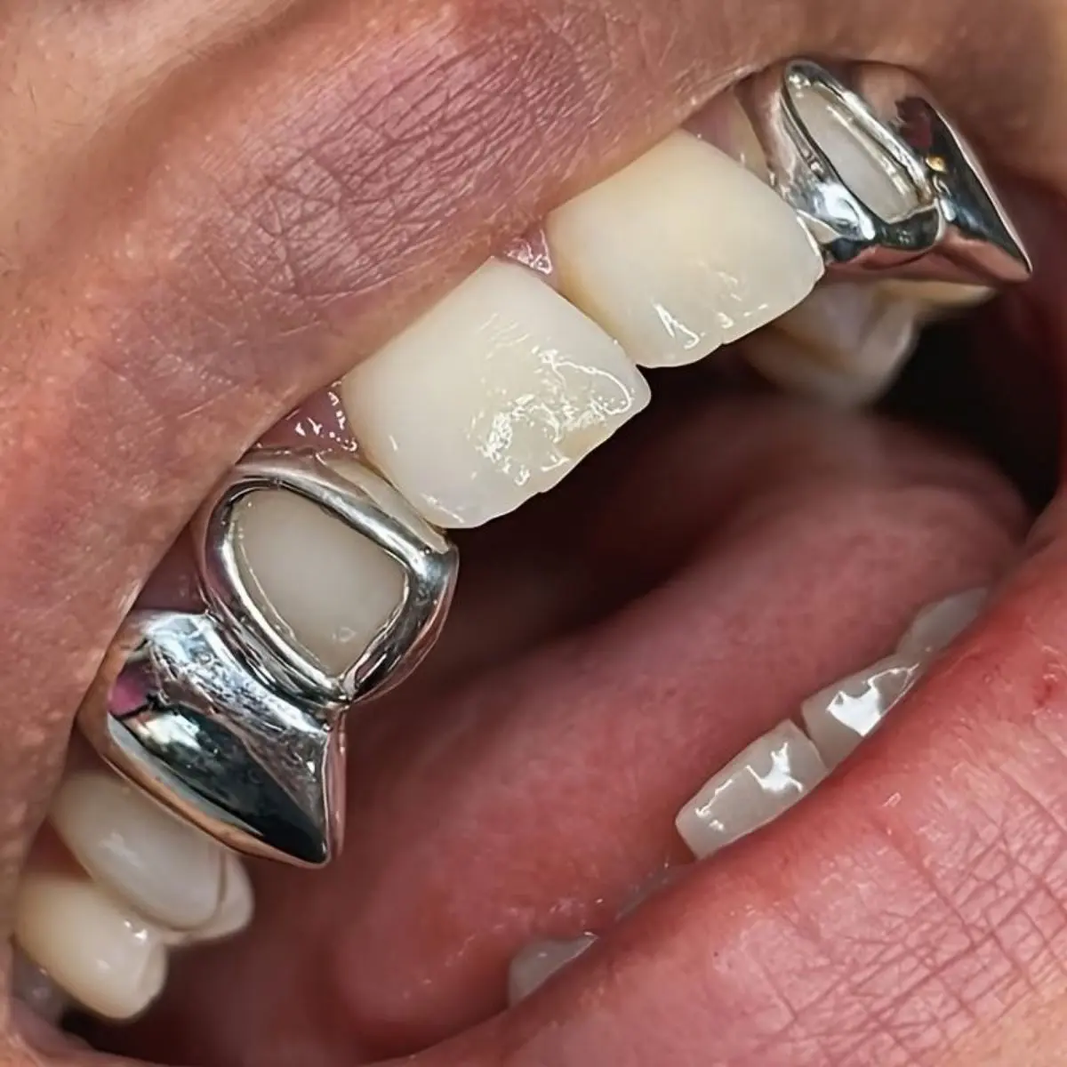 popular2pcs/SET Hip Hop Double Fang Teeth Grillz for Teeth Golden Color Plated Canine Two Tooth Upper Top Fangs Hollow Vampire Teeth Grills Jewelry symmetry on both sides  Oral Cosmetic  Ceramic Braces