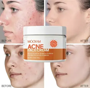 MOOYAM Acne Scar Treatment Cream 3.5oz with Centella & Snail Repair Salicylic Acid Formula for Cystic Hormonal Acne Breakouts Fragrance Free Paraben Free,Facial Repair Treatment viral product