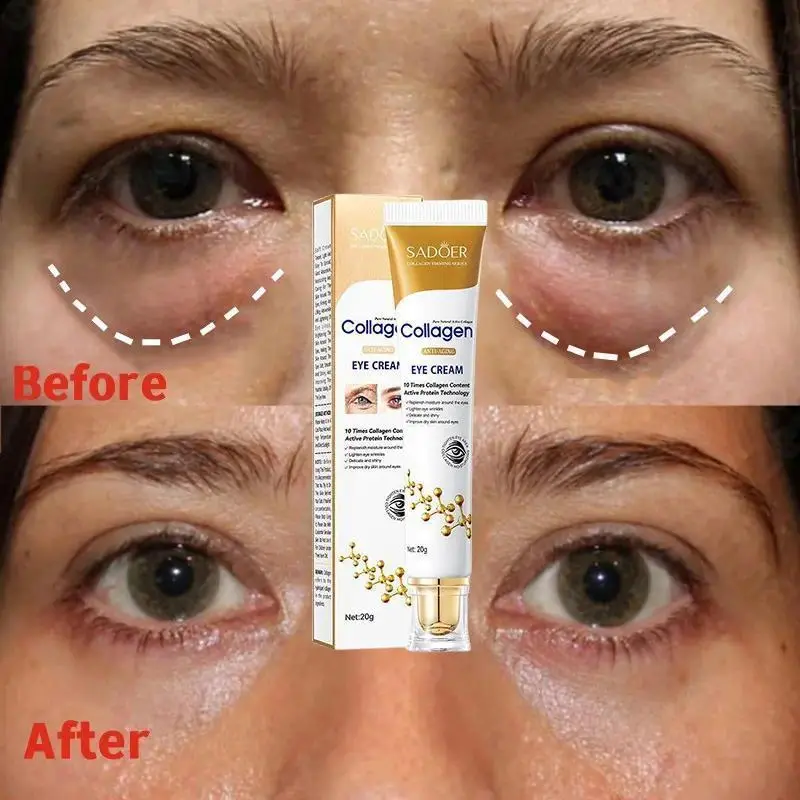Collagen Eye Cream, Instant Dark Circles Treatment, Wrinkles & Fine Lines Fader, Skin Firming, Anti-Puffiness, Hydrating Moisturizer for Eye Repair, Suitable For All, Under-Eye Care