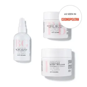 Stretch Mark Prevention Trio by The Spoiled Mama