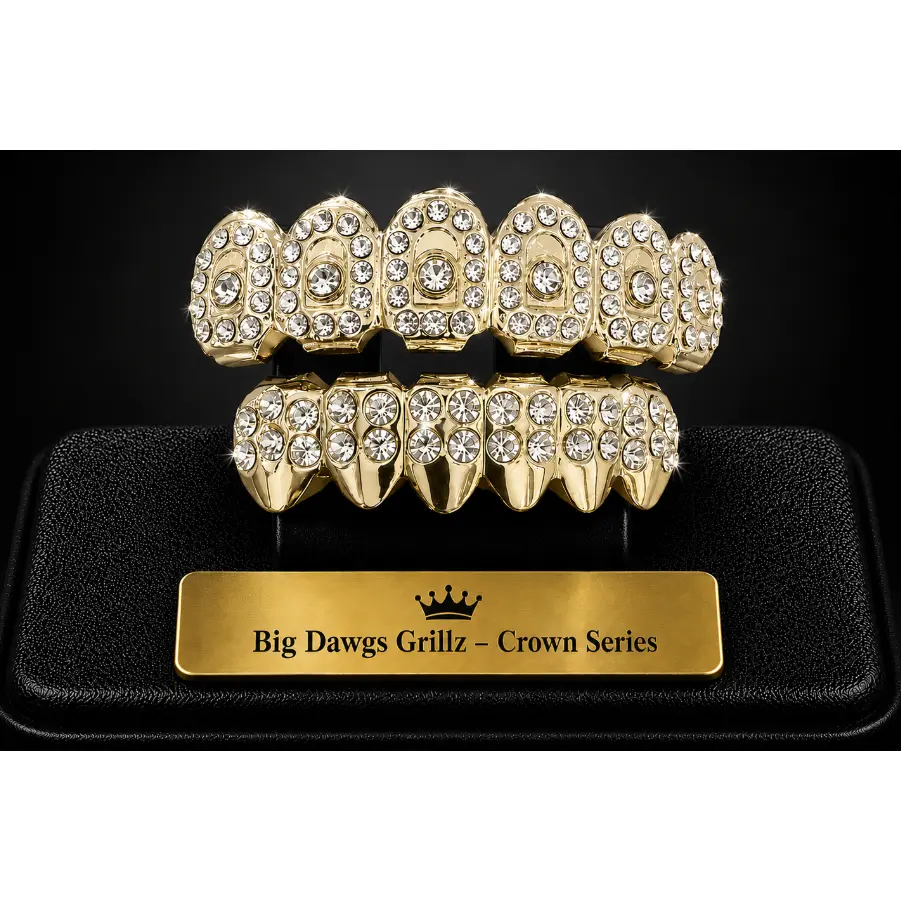 14K Gold Plated Upper & Lower Grillz Set Crown Series