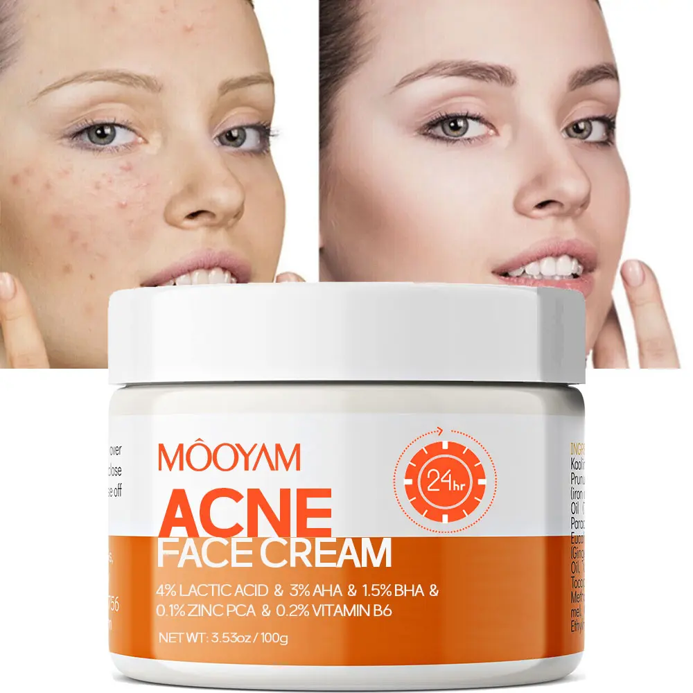 mooyam Acne Scar Treatment Cream (50ml) with Centella, Snail Repair & Multiple Acids for Post-Acne Marks - Fragrance-Free Therapeutic Facial Cream for Sensitive Skin, Reduces Acne