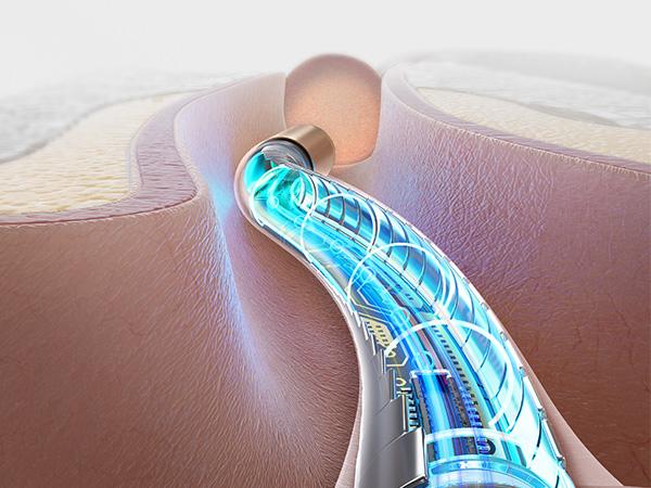 Ear Wax Removal Tool Camera, Flexible Wireless Ear Cleaner with Camera Otoscope Light, HD Painless Visual Ear Picker Tweezers Earwax Remover, Portable Safe Ear Cleaning Kit for Adults & Kids