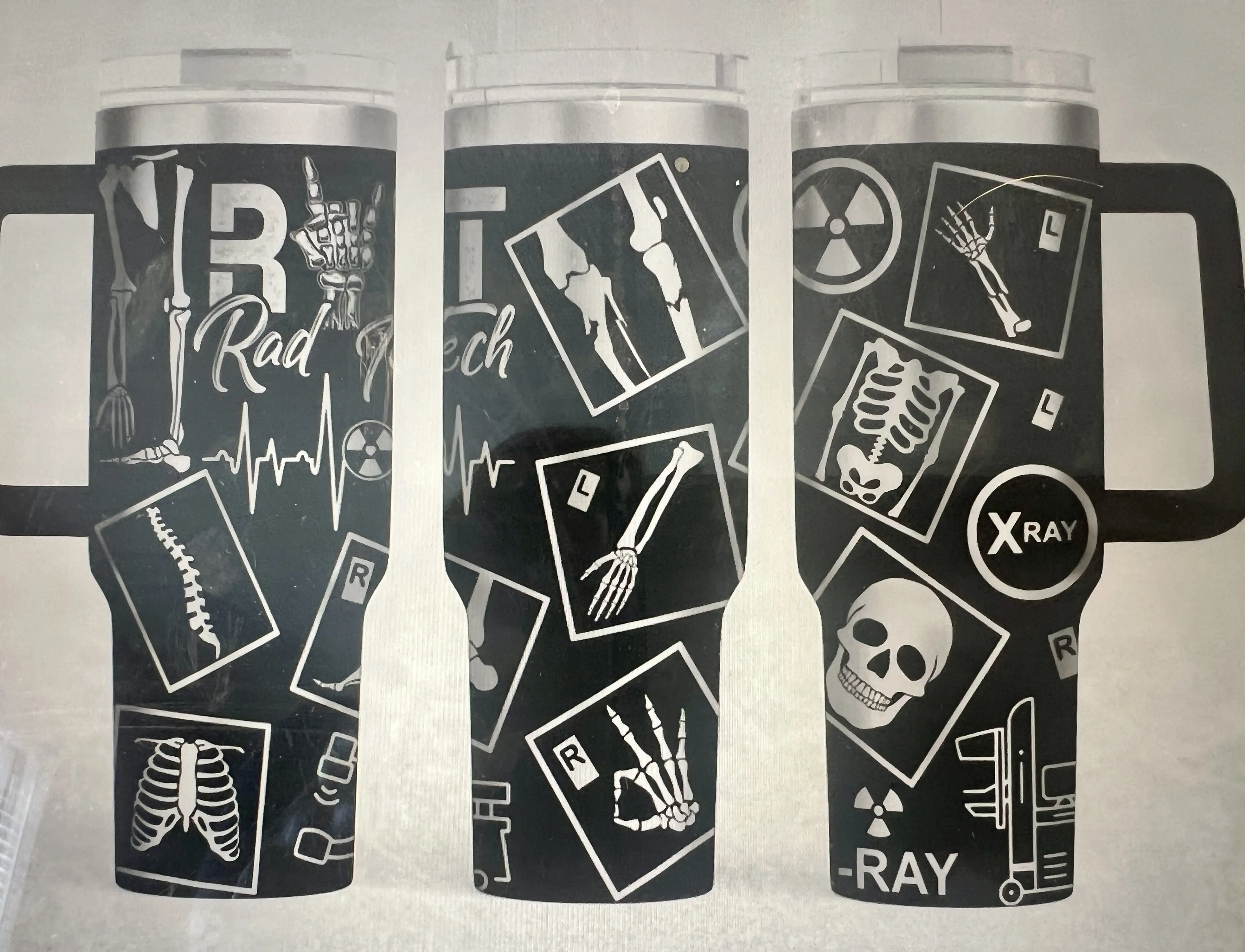 Laser Engraved Radiology/Xray  Design 40 Oz Tumbler- Drinkware, Gifts, Personalized