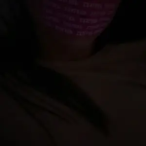 ZZSLEEP Restore Pink Mouth Tape (30 Srips) – Hydrating Lip-Mask Center with Collagen, Vitamin E + Hyaluronic Acid – Breathable, Skin-Friendly Sleep Tape for Nasal Breathing & Restful Recovery