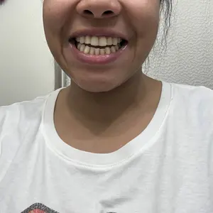 【MSDRWIKEY】New 7-Pro Intensive Toothpaste | Upgraded Purple Formula with 7 Probiotics | Deep Enamel Repair & Long-Lasting Freshness