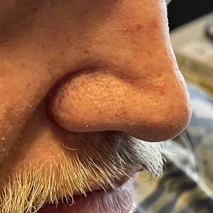 Product Review of [Dr.Melaxin Official] Peel Shot Glow Rice Ampoule Duo - Serums for Brightening, Exfoliating, and Moisturizing - Suitable for All Skin Types from j**7