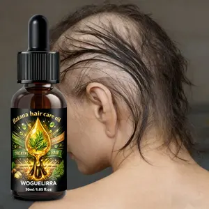 Battana Hair Oil, Castor Oil, Biotin, Ginger, 30ML, Supports Healthy Hair, Protects Scalp, Repairs Split Ends, Fuller Look