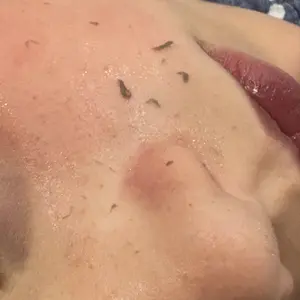 Product Review of [Dr.Melaxin Official] Peel Shot Glow Rice Ampoule Duo - Serums for Brightening, Exfoliating, and Moisturizing - Suitable for All Skin Types from L**e H**r