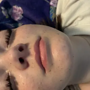 Product Review of [Dr.Melaxin Official] Peel Shot Glow Rice Ampoule Duo - Serums for Brightening, Exfoliating, and Moisturizing - Suitable for All Skin Types from -**y K** D**_