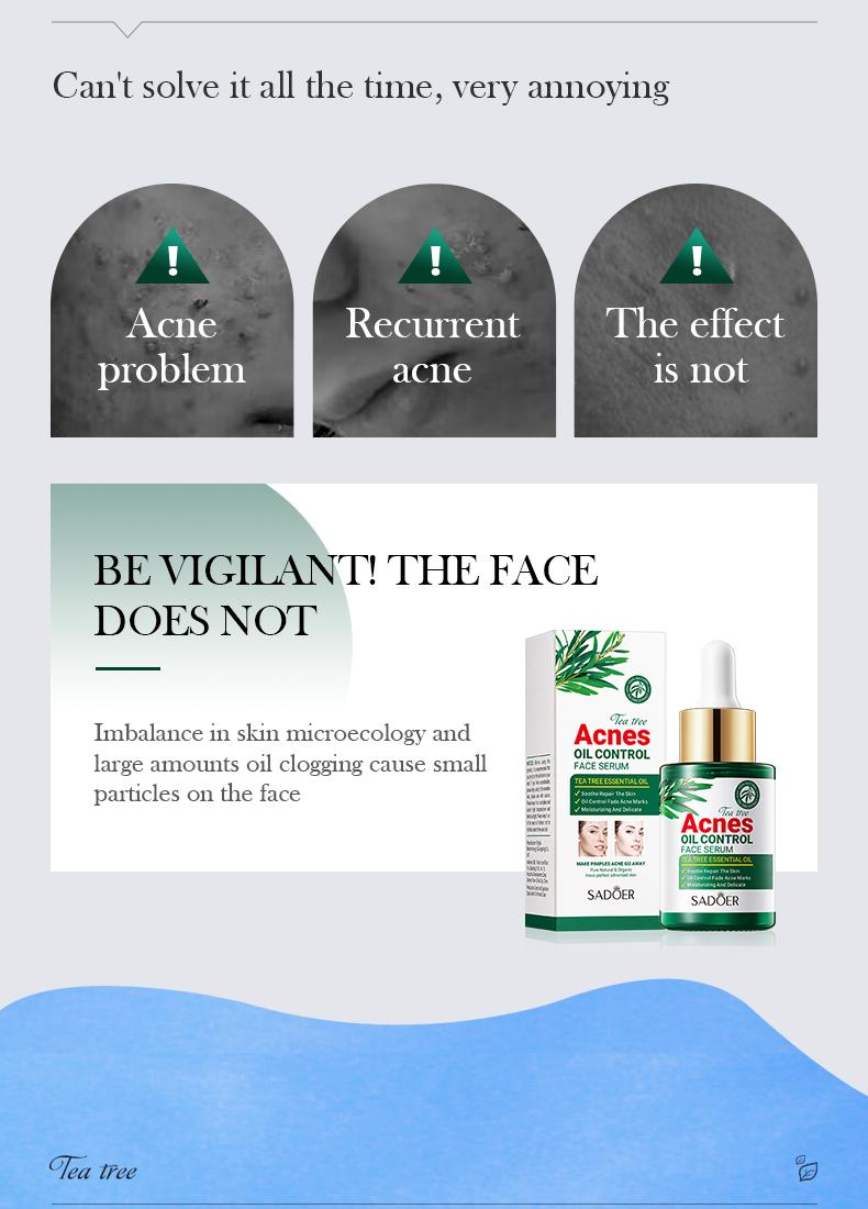 Tea tree acne oil control essence, lightens acne marks, natural cleansing and acne removal, removes blackheads, repairs skin essence