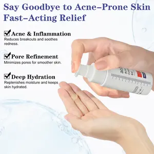 Acne Control Gel with AHA BHA | Salicylic Acid Acne Treatment | Clear Breakouts, Shrink Pores & Smooth Skin Fast