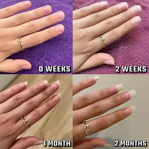 3Bottles Nail Growth Oil - Moisturizing, Growth, Strengthening, and Brightening Formula  Overall Nail Radiant cosmetic Moisture Nail Care Polish