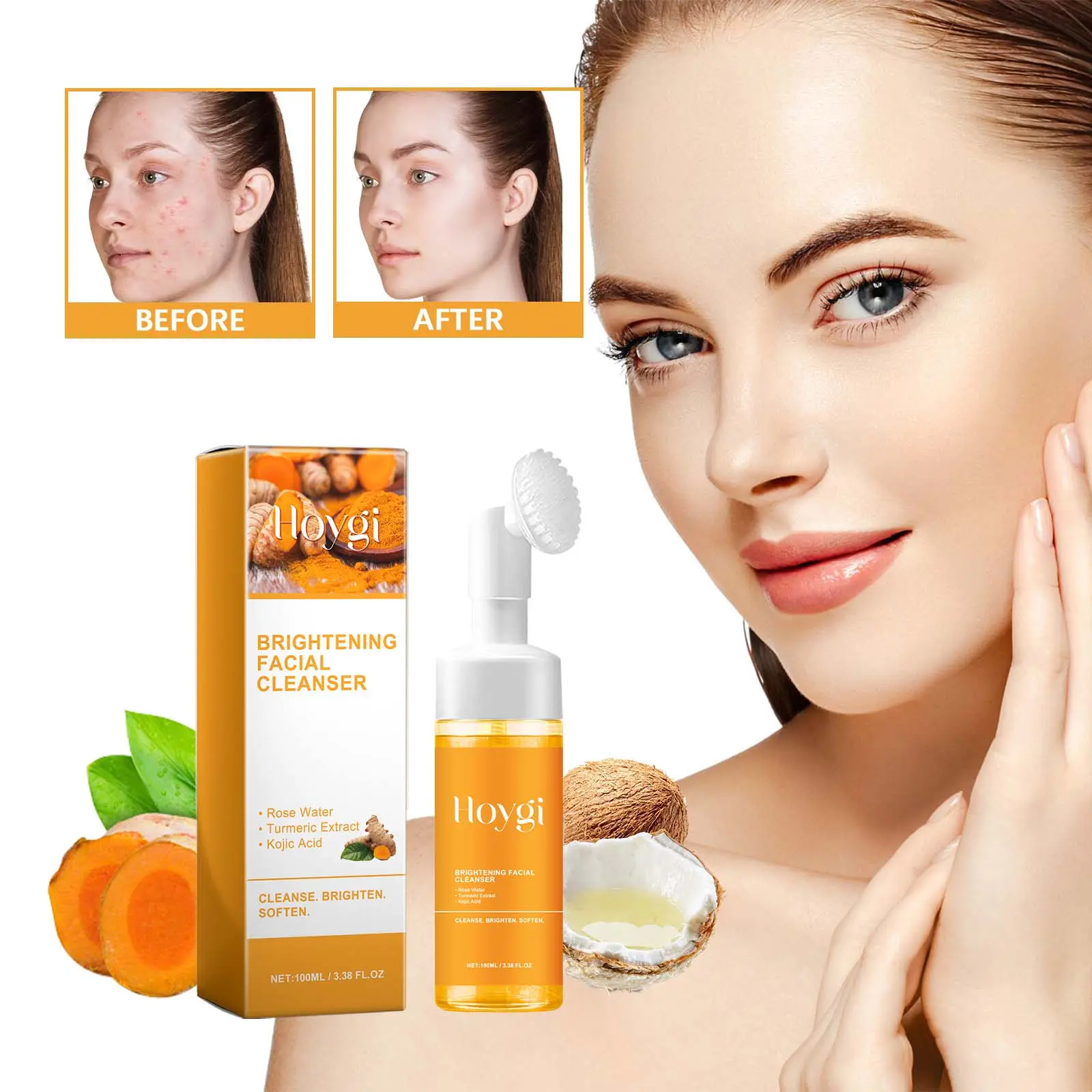 Hoygi Curcuma Facial Cleanser with Kojic Acid - Deep Cleansing Foam for Acne Marks & Pigmentation - Nourishing & Brightening Skincare Formula