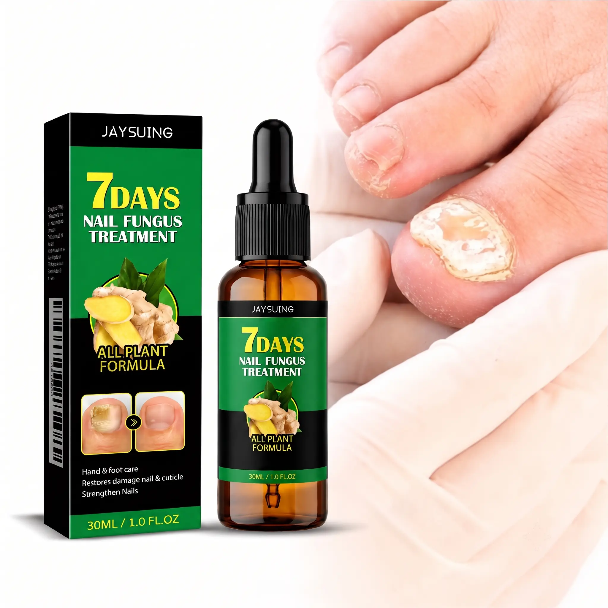 Powerful Ginger Nail Care Serum - Improves Appearance of Discolored, Thickened & Damaged Nails, Restorative Triple Action Formula, 1 Fl Oz