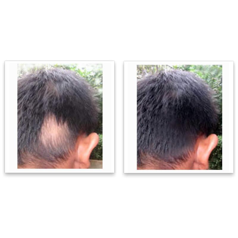 Caboki 10X Hair Powder - LIMIT ONE PER HOUSEHOLD. Full Coverage for Hairline & Thin Areas, Talc-Free Formula, Natural Ingredients, Waterproof, TRIAL SIZE