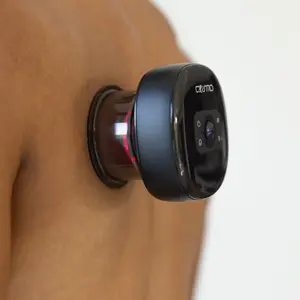 Cosmo NovaCup: Advanced Cupping Therapy Device for Pain Relief, Recovery, Mobility, & Comfort