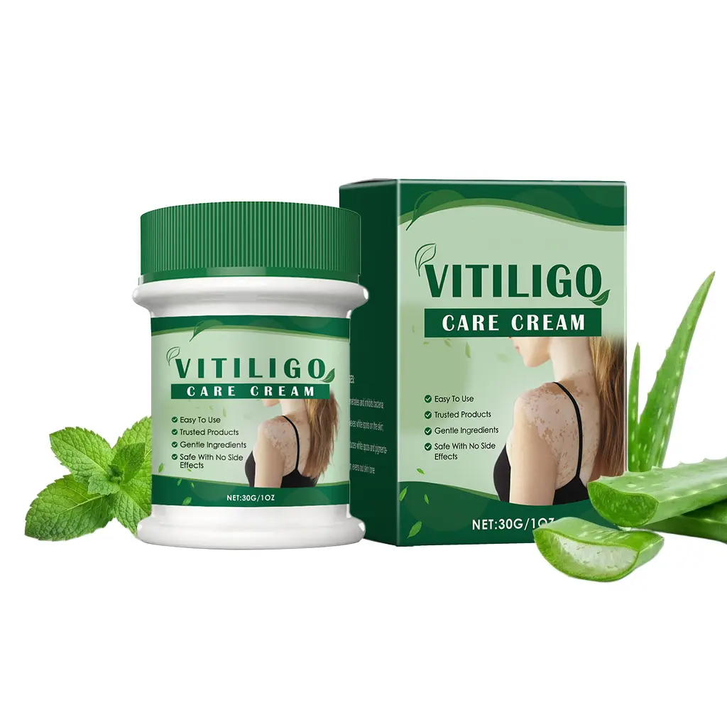 Vitiligo Treatment Cream for Calming Barrier Repair, Tone Correcting Body Moisturizer with Mint & Aloe for Dark Spots, Moisturizers, Color Correction, Smooth, Body Care, Daytime, 30G, Lightweight, Mint Leaf, Natural, Skin Repair, Dark Spot Remover