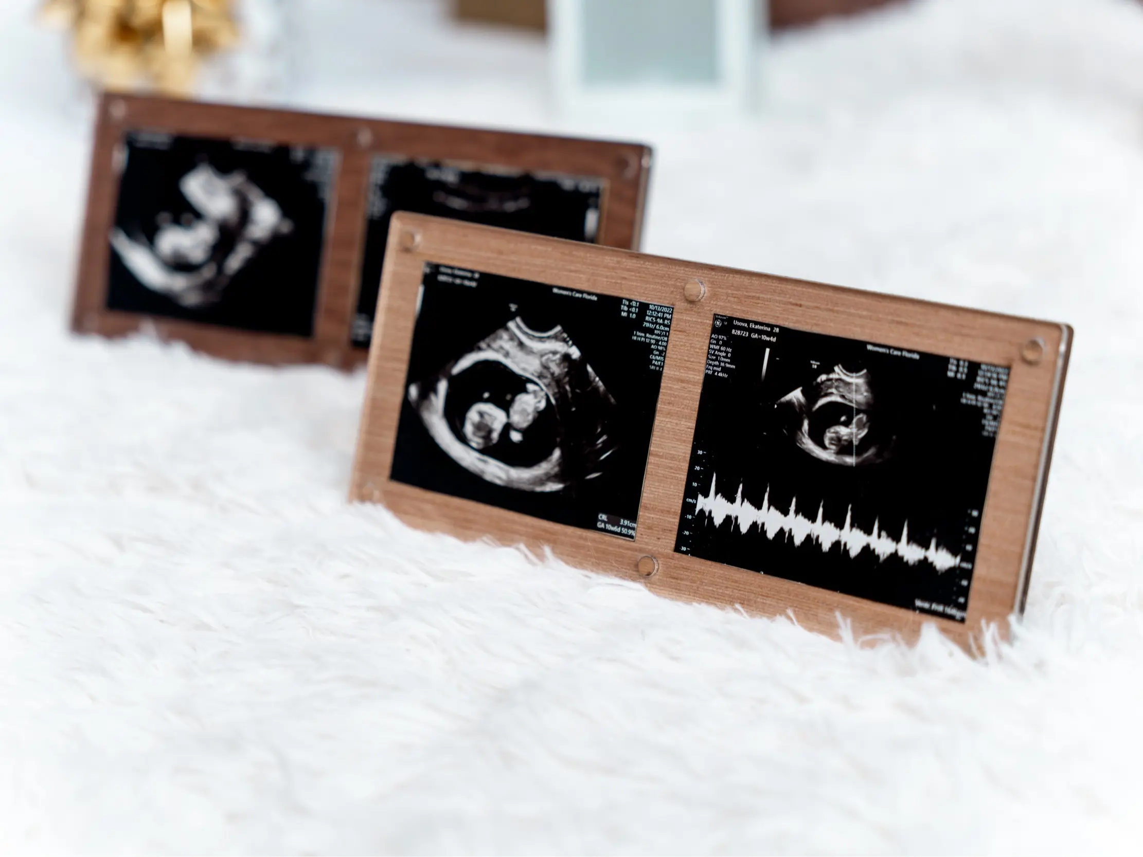 Ultrasound Frame: Baby Keepsake Picture Frame, Holds 2 images
