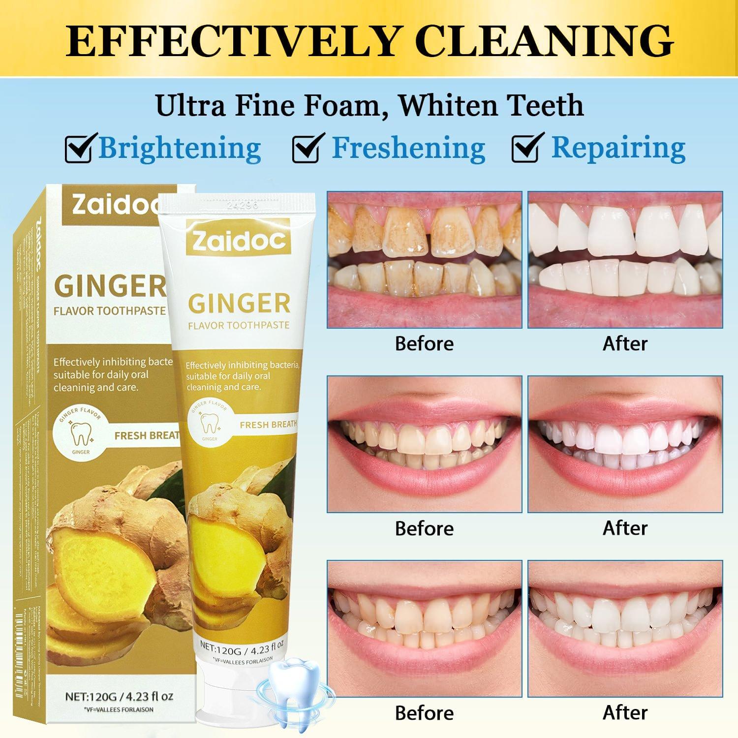Zaidoc Ginger Toothpaste | Remove Stains, Repair Gums, Freshen Breath, Fluoride-Free, Safe for Sensitive Teeth 120g