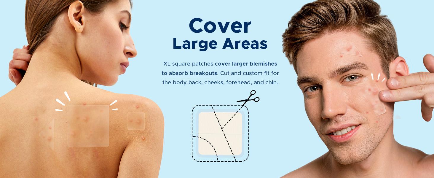 TKTK Hydrocolloid Bandages, 45 x 45 mm Large Pimple Patches for Face, XL Acne Patches for Body, Back, Forehead, Cheek Zit Breakouts, Big Hydrocolloid Patch (Square, Strip, Dot 5 Sizes 120 Count)
