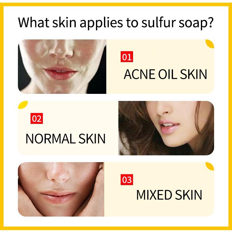 2/4/6Pc Zudaifu Sulfur Soap Cleanser Bar Body Wash Oil Control Gentle Cleansing for Body Care with Plant Extracts for Eczema Dry Acne Skin Relief 80g