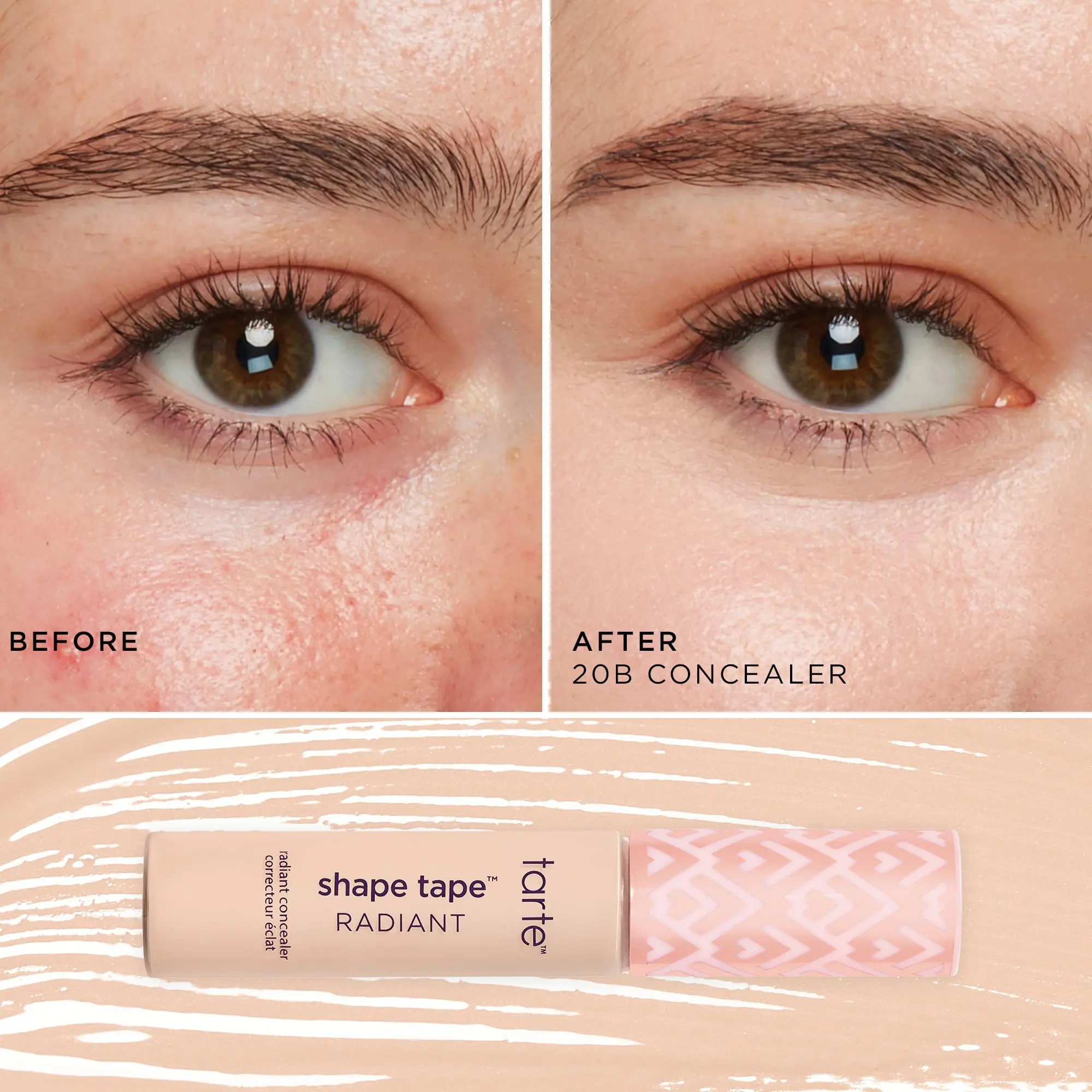 20B light (light skin with cool