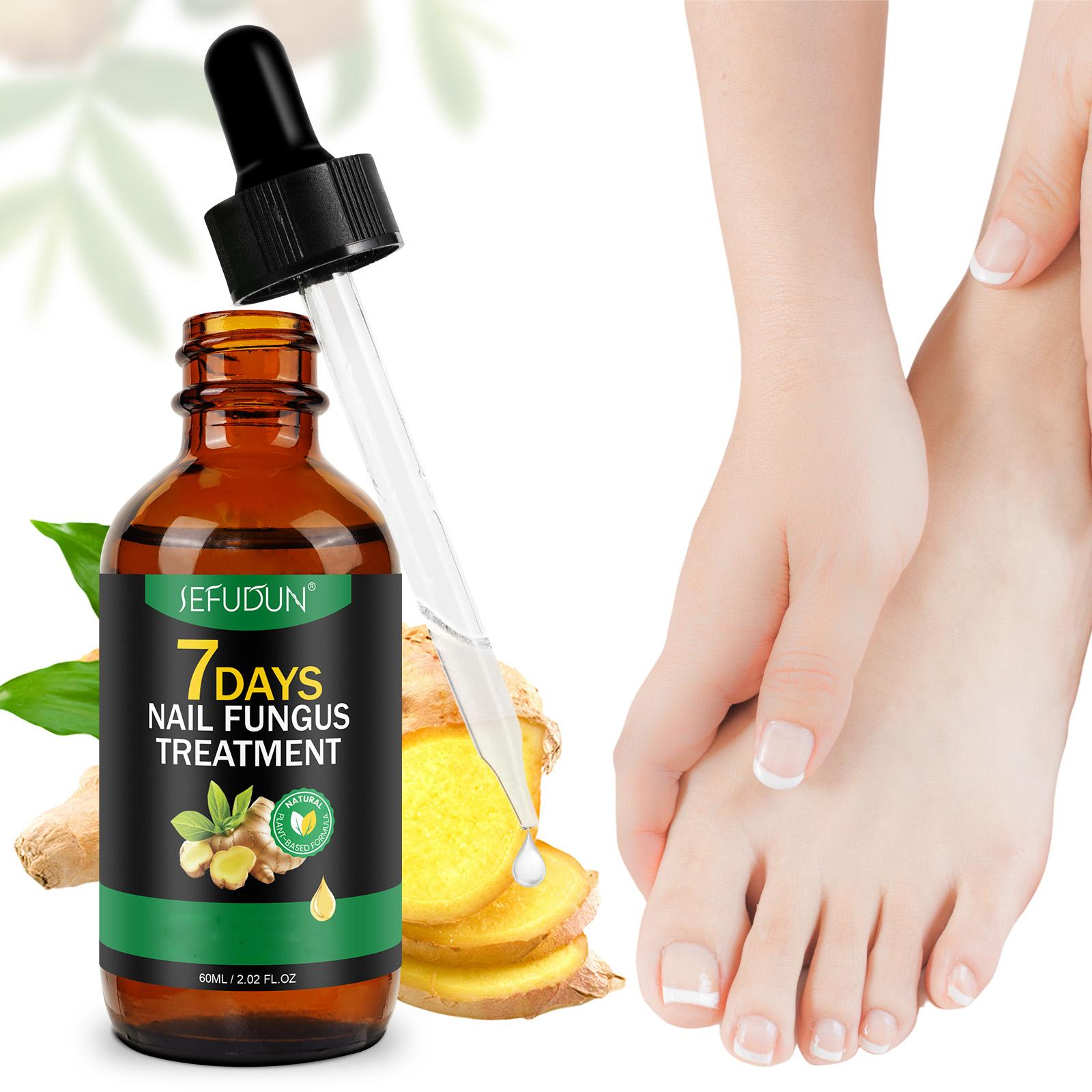 Sefudun Ginger Cuticle Nourish Nail Nutrient Oil - 60ml Unisex Adults' Nail Care Essence with Jojoba & Botanical Extracts for Deep Hydration & Repair