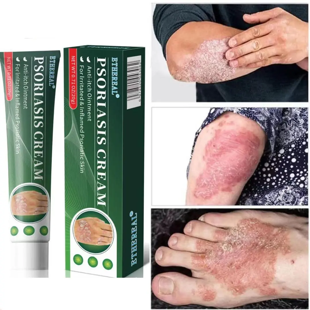 Fragrance Free Cream for Psoriasis & Eczema, All-Natural Soothing Cream  – Best Gift, Herbal Relief for Dry, Itchy, Scalp Psoriasis, Sensitive Skin , Anti-Bacterial Skin Defense (Hydrating, Safe for All Ages | 20g) Treatment