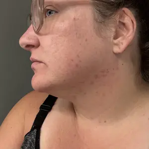 Product Review of [medicube] Affordable Glass Glow Skincare Set | Includes 8 products for Gentle Skin Glow Routine from S**e