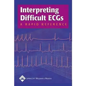 USED-Interpreting Difficult ECGs: A Rapid Reference by Springhouse (Paperback)